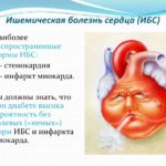Инфаркт, аритмия и стенокардия