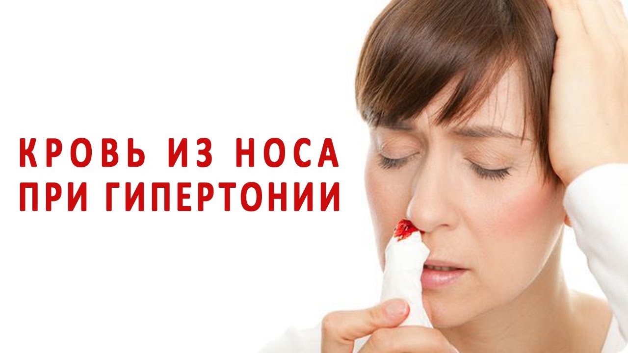 Кровь идет из носа при давлении регулярно