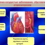 Заболевания сердца или сосудов