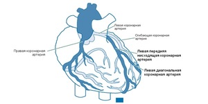 Операция на сердце