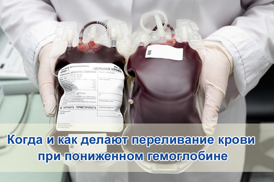 Сколько времени переливание крови. Переливание крови при низком гемоглобине. Переливание донорской крови. Переливаниекрове при низком гемоглобине.