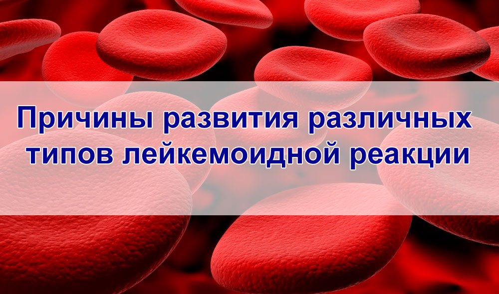 Эритремия. Образ жизни при эритремии. Эритремия диагностика. Лейкемоидная реакция при эритремии. Реакция крови человека.