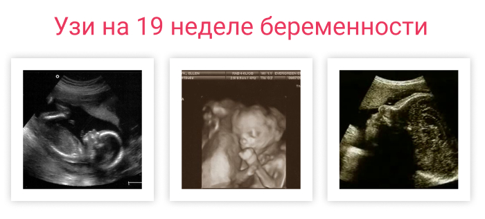 19 недель воды. Как выглядит ребенок на УЗИ В 19 недель. УЗИ 18 19 недель беременности фото. Размер плода на 19 неделе беременности УЗИ.
